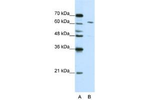 WB Suggested Anti-CPSF6 Antibody Titration:  0. (CPSF6 antibody  (Middle Region))