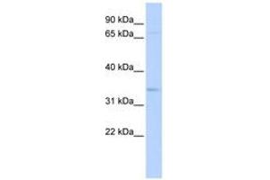 Image no. 1 for anti-CHRNA7 (Cholinergic Receptor, Nicotinic, alpha 7, Exons 5-10) and FAM7A (Family with Sequence Similarity 7A, Exons A-E) Fusion (CHRFAM7A) (AA 180-229) antibody (ABIN6740421) (CHRFAM7A antibody  (AA 180-229))