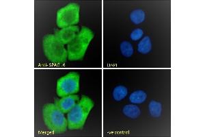 (ABIN570832) Immunofluorescence analysis of paraformaldehyde fixed A431 cells, permeabilized with 0. (SPAG16 antibody  (AA 139-152))