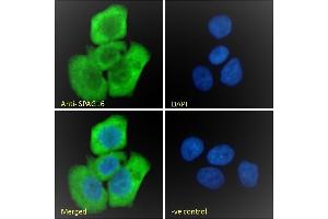 (ABIN570832) Immunofluorescence analysis of paraformaldehyde fixed A431 cells, permeabilized with 0.