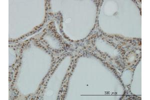 Immunoperoxidase of monoclonal antibody to POLR1C on formalin-fixed paraffin-embedded human thyroid nodular goiter. (POLR1C antibody  (AA 1-346))