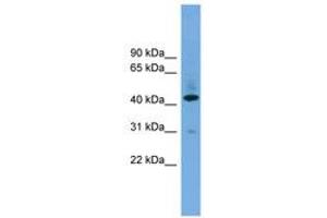 Image no. 1 for anti-UDP-Gal:betaGlcNAc beta 1,4- Galactosyltransferase, Polypeptide 2 (B4GALT2) (AA 251-300) antibody (ABIN6744776) (B4GALT2 antibody  (AA 251-300))