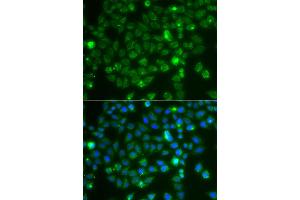 Immunofluorescence analysis of A549 cells using RAC1 antibody. (RAC1 antibody)