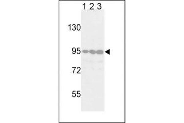 DDR2 抗体