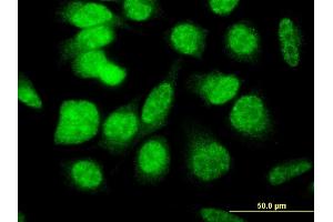 Immunofluorescence of monoclonal antibody to E4F1 on HeLa cell. (E4F1 antibody  (AA 685-784))