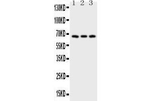 Anti-CD30 Picoband antibody, All lanes: Anti-CD30 at 0. (TNFRSF8 antibody  (AA 322-595))