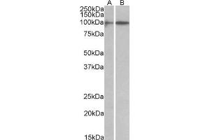 ABIN1590055 (1 µg/mL) staining of A549 (A) and Jurkat (B) lysates (35 µg protein in RIPA buffer). (HIC1 antibody  (AA 193-204))