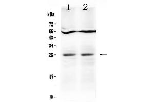 Western blot analysis of LIGHT  using anti-LIGHT  antibody .