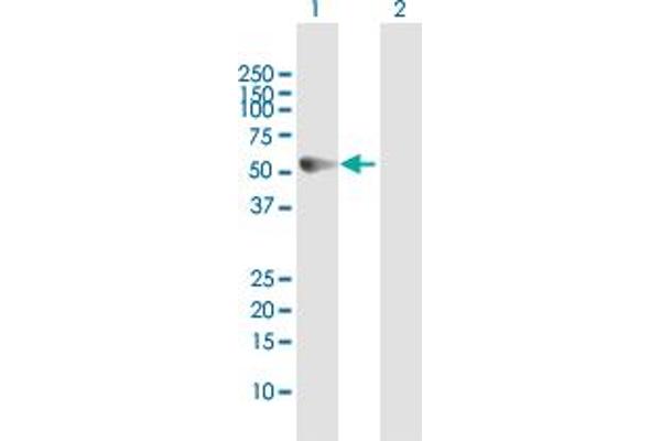 KRT83 antibody  (AA 1-493)