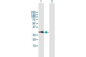 Western Blot analysis of MGC3036 expression in transfected 293T cell line by MGC3036 MaxPab polyclonal antibody.