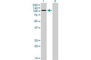 Western Blot analysis of EPHA3 expression in transfected 293T cell line by EPHA3 monoclonal antibody (M01), clone 3A12.