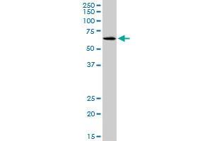 SLC17A4 monoclonal antibody (M03), clone 3E4. (SLC17A4 antibody  (AA 56-131))