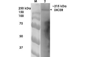 Western Blot analysis of Rat Brain Membrane showing detection of ~215 kDa Dicer protein using Mouse Anti-Dicer Monoclonal Antibody, Clone S167-7 . (DICER1 antibody  (AA 1638-1899) (Biotin))