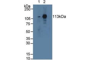 Western blot analysis of (1) Rat Serum and (2) Mouse Lung Tissue. (STAT2 antibody  (AA 587-838))