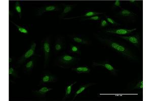Immunofluorescence of monoclonal antibody to PRMT6 on HeLa cell. (PRMT6 antibody  (AA 1-316))