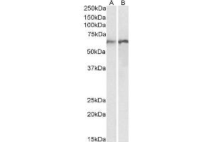 ABIN4902558 (0. (Calreticulin antibody)