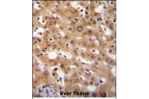 GGCX Antibody (Center) (ABIN655069 and ABIN2844699) immunohistochemistry analysis in formalin fixed and paraffin embedded human liver tissue followed by peroxidase conjugation of the secondary antibody and DAB staining. (GGCX antibody  (AA 548-578))