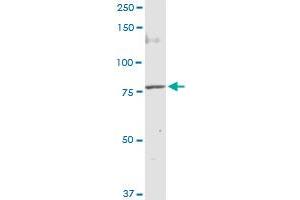 MUT MaxPab rabbit polyclonal antibody. (MUT antibody  (AA 1-750))
