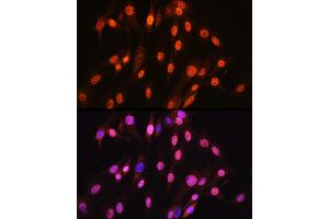 Immunofluorescence analysis of C6 cells using SOX10 Rabbit mAb (ABIN7270566) at dilution of 1:100 (40x lens). (SOX10 antibody)