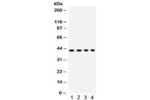 Western blot testing of 1) rat liver, 2) human HeLa, 3) SW620 and 4) mouse HEPA lysate with PARVA antibody.
