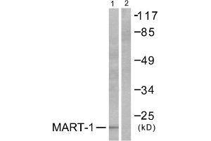 Western blot analysis of extracts from NIH/3T3 cells, using MART-1 antibody (ABIN5976450). (MLANA antibody  (Internal Region))