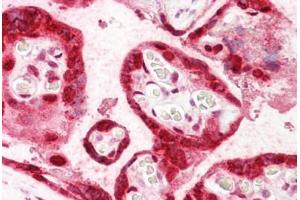 Anti-HMGB3 antibody IHC staining of human placenta. (HMGB3 antibody  (AA 150-200))