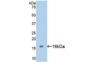 Detection of Recombinant GAL7, Human using Monoclonal Antibody to Galectin 7 (GAL7) (LGALS7 antibody  (AA 1-136))