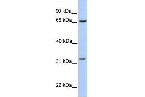 WB Suggested Anti-PBK Antibody Titration:  0. (PBK antibody  (N-Term))