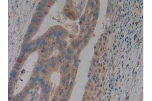 Immunohistochemistry (IHC) image for anti-Lipocalin 2 (LCN2) (AA 21-198) antibody (ABIN7433588)