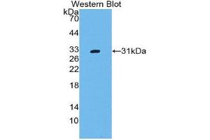 Western Blotting (WB) image for anti-CD109 (CD109) (AA 719-965) antibody (ABIN2119840) (CD109 antibody  (AA 719-965))