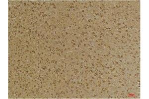 Immunohistochemistry (IHC) analysis of paraffin-embedded Mouse Brain Tissue using GABA A Receptor gamma2 Rabbit Polyclonal Antibody diluted at 1:200. (GABRG2 antibody)