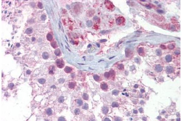 SYCP3 antibody  (N-Term)