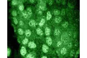 A431 cells were serum starved and treated with EGF (100 ng/ml) for 5 minutes, then fixed in 1:1 methanol-acetone for 10 minutes at -20°C. (STAT3 antibody  (pSer727))