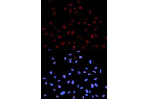 Immunofluorescence (IF) image for anti-Met Proto-Oncogene (MET) (pTyr1235) antibody (ABIN1870439) (c-MET antibody  (pTyr1235))