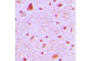 Immunohistochemical analysis of ARNT2 staining in human brain formalin fixed paraffin embedded tissue section. (ARNT2 antibody  (N-Term))