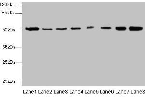 Western blot All lanes: PGS1 antibody at 2 μg/mL Lane 1: Mouse liver tissue Lane 2: Hela whole cell lysate Lane 3: Jurkat whole cell lysate Lane 4: HepG2 whole cell lysate Lane 5: THP-1 whole cell lysate Lane 6: Mouse spleen tissue Lane 7: Mouse thymus tissue Lane 8: Mouse kidney tissue Secondary Goat polyclonal to rabbit IgG at 1/10000 dilution Predicted band size: 63, 52, 38, 6 kDa Observed band size: 52 kDa (PGS1 antibody  (AA 110-400))