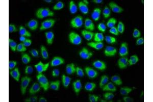 Immunofluorescence staining of Hela cells with ABIN7154478 at 1:133, counter-stained with DAPI. (GAS1 antibody  (AA 248-318))