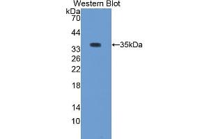 Western Blotting (WB) image for anti-Protein Kinase C, beta 1 (Pkc beta 1) (AA 342-600) antibody (ABIN2118925) (Pkc beta 1 antibody  (AA 342-600))