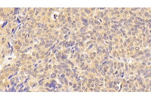Immunohistochemistry (IHC) image for anti-Wingless-Type MMTV Integration Site Family, Member 7B (WNT7B) (AA 216-349) antibody (ABIN7430198)