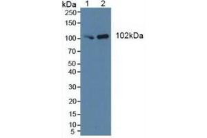 Western blot analysis of (1) Human HeLa cells and (2) Porcine Brain Tissue. (PIK3C3 antibody  (AA 631-885))