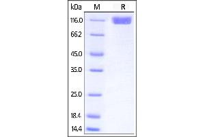 Human CD117, Fc Tag on SDS-PAGE under reducing (R) condition. (KIT Protein (AA 26-516) (Fc Tag))