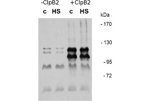 Image no. 2 for anti-ClpB2 Gene Product (CLPB2) antibody (ABIN334578) (CLPB2 antibody)