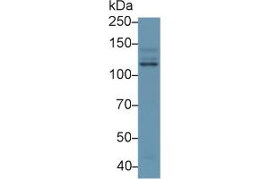 Western blot analysis of Human HeLa cell lysate, using Human PIK3Cb Antibody (1 µg/ml) and HRP-conjugated Goat Anti-Rabbit antibody (