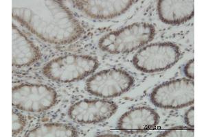 Immunoperoxidase of monoclonal antibody to KDM5B on formalin-fixed paraffin-embedded human colon. (KDM5B antibody  (AA 231-319))