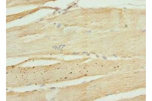 Immunohistochemistry of paraffin-embedded human skeletal muscle tissue using ABIN7157611 at dilution of 1:100 (KIF1B antibody  (AA 1547-1816))