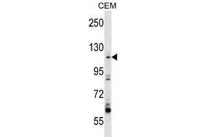 ARHGEF1 Antibody (N-term) western blot analysis in CEM cell line lysates (35µg/lane). (ARHGEF1 antibody  (N-Term))