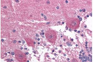 Human Brain, Cerebellum (formalin-fixed, paraffin-embedded) stained with PAX3 antibody ABIN214133 at 5 ug/ml followed by biotinylated goat anti-rabbit IgG secondary antibody ABIN481713, alkaline phosphatase-streptavidin and chromogen. (Paired Box 3 antibody  (AA 400-449))