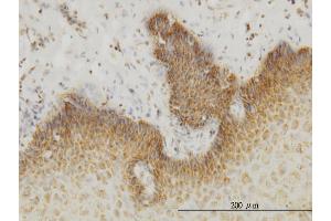 Immunoperoxidase of monoclonal antibody to INSRR on formalin-fixed paraffin-embedded human esophagus. (INSRR antibody  (AA 651-760))