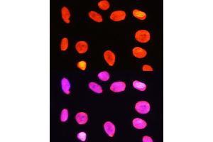 Immunofluorescence analysis of C6 cells using Symmetric DiMethyl-Histone H3-R2 Rabbit pAb (ABIN3016053, ABIN3016054, ABIN3016055, ABIN1680220 and ABIN6219534) at dilution of 1:100 (40x lens). (Histone 3 antibody  (H3R2me2))