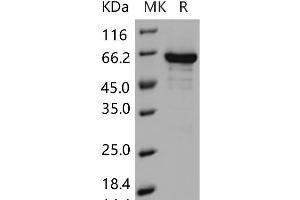 Western Blotting (WB) image for EPH Receptor B1 (EPHB1) (Active) protein (GST tag,His tag) (ABIN7320010) (EPH Receptor B1 Protein (EPHB1) (GST tag,His tag))